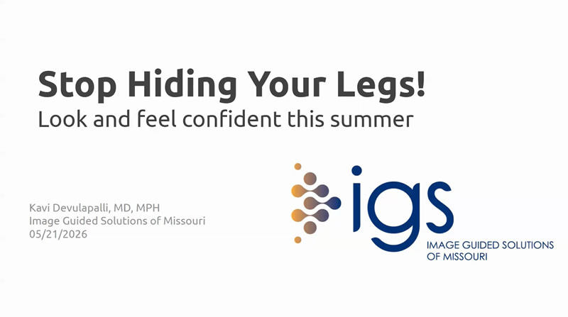 webinar varicose vein treatment